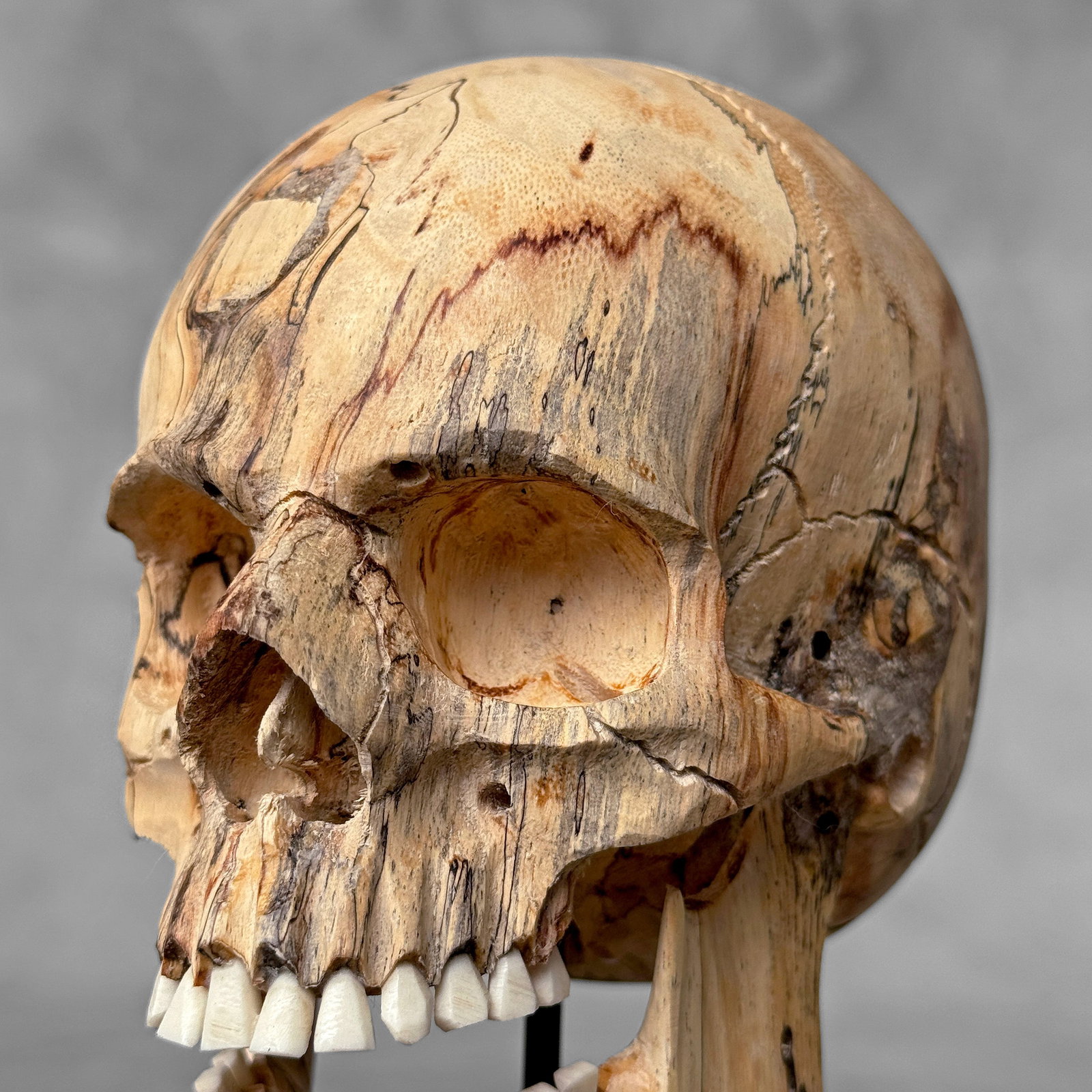 Wonderful human skull with a beautiful grain on a custom stand - 3