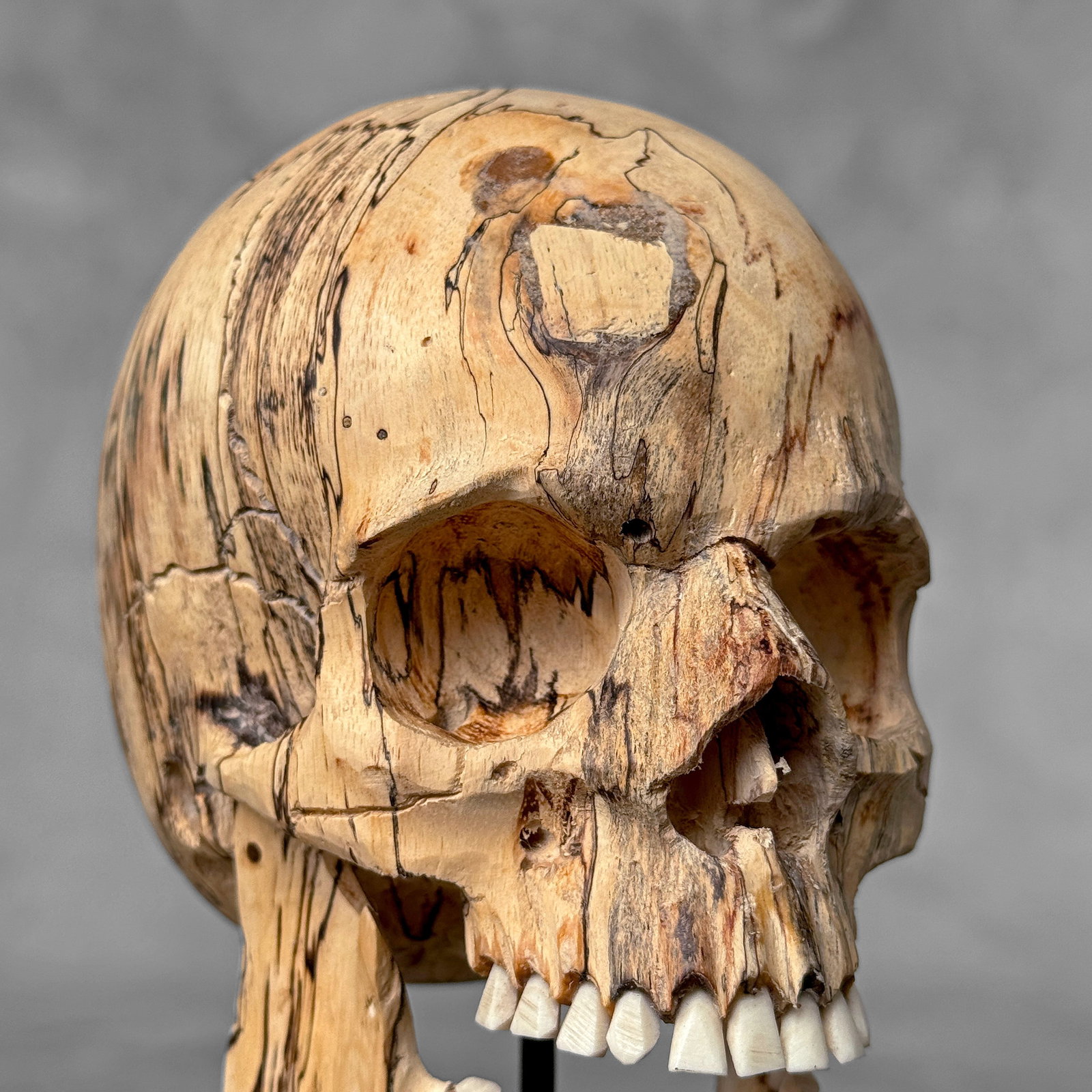 Wonderful human skull with a beautiful grain on a custom stand - 7