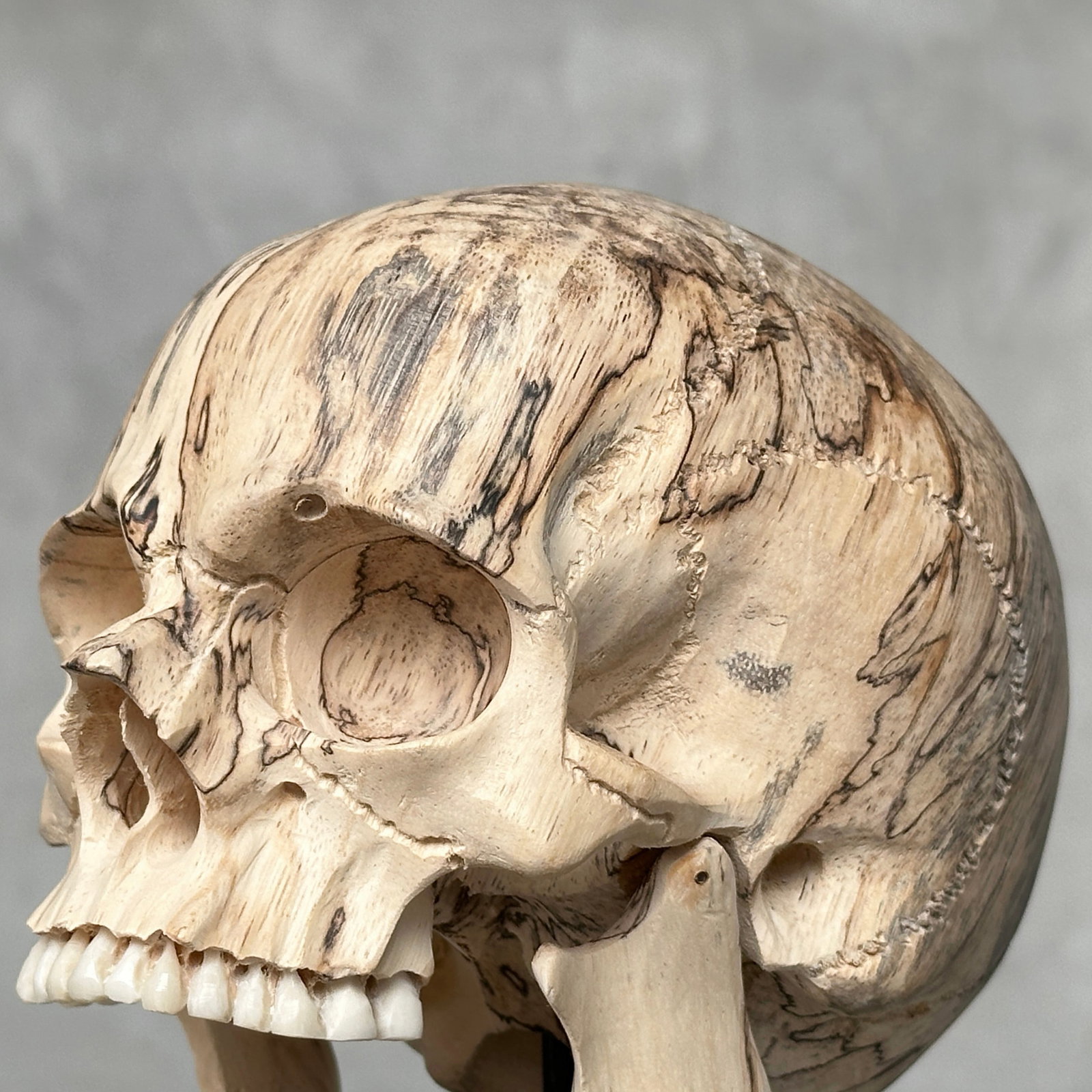 Wonderful human skull with a beautiful grain on a custom stand - 3