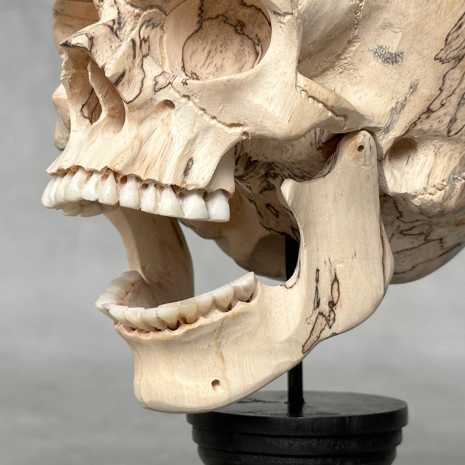 Wonderful human skull with a beautiful grain on a custom stand - 4