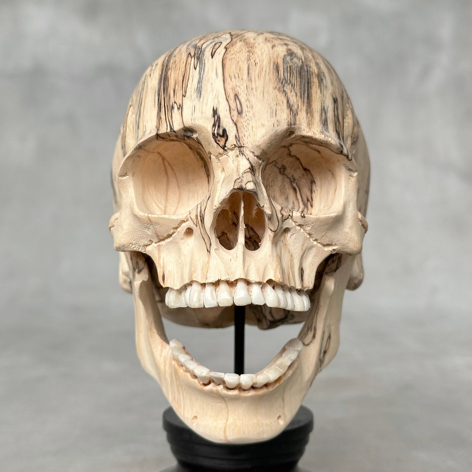 Wonderful human skull with a beautiful grain on a custom stand - 5