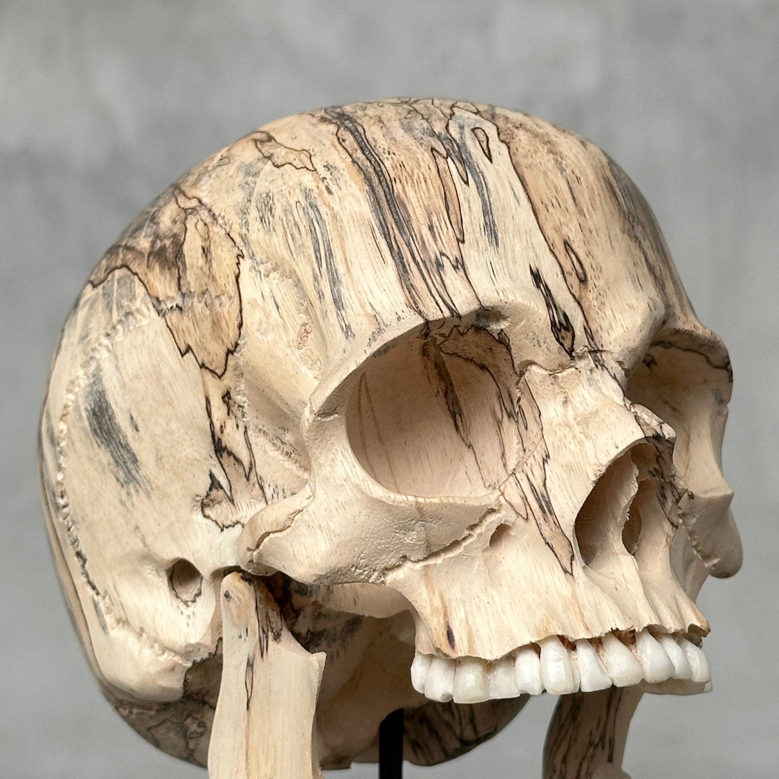 Wonderful human skull with a beautiful grain on a custom stand - 7