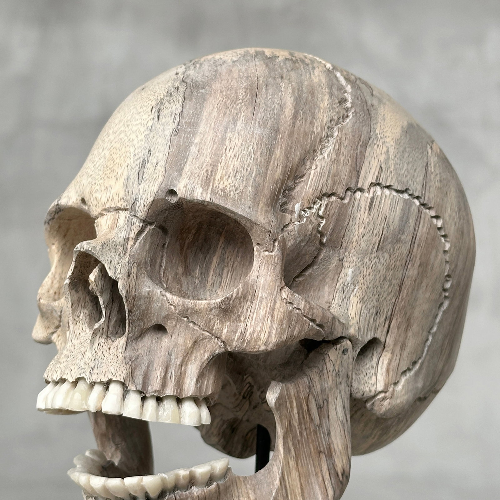 Wonderful human skull with a beautiful grain on a custom stand - 3