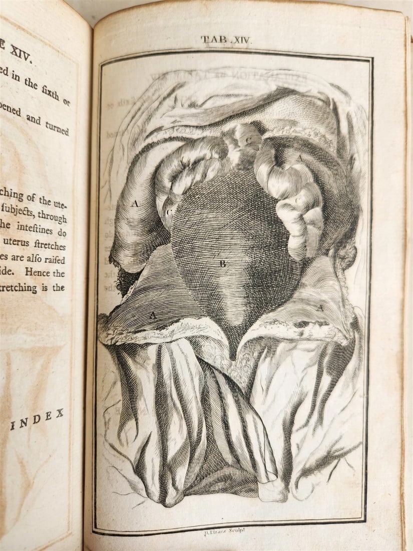 1791 System of Anatomy & Physiology ANTIQUE 3 vols. ILLUSTRATED - 12