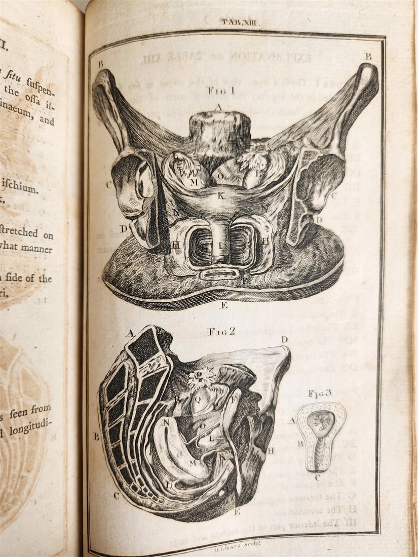 1791 System of Anatomy & Physiology ANTIQUE 3 vols. ILLUSTRATED - 13