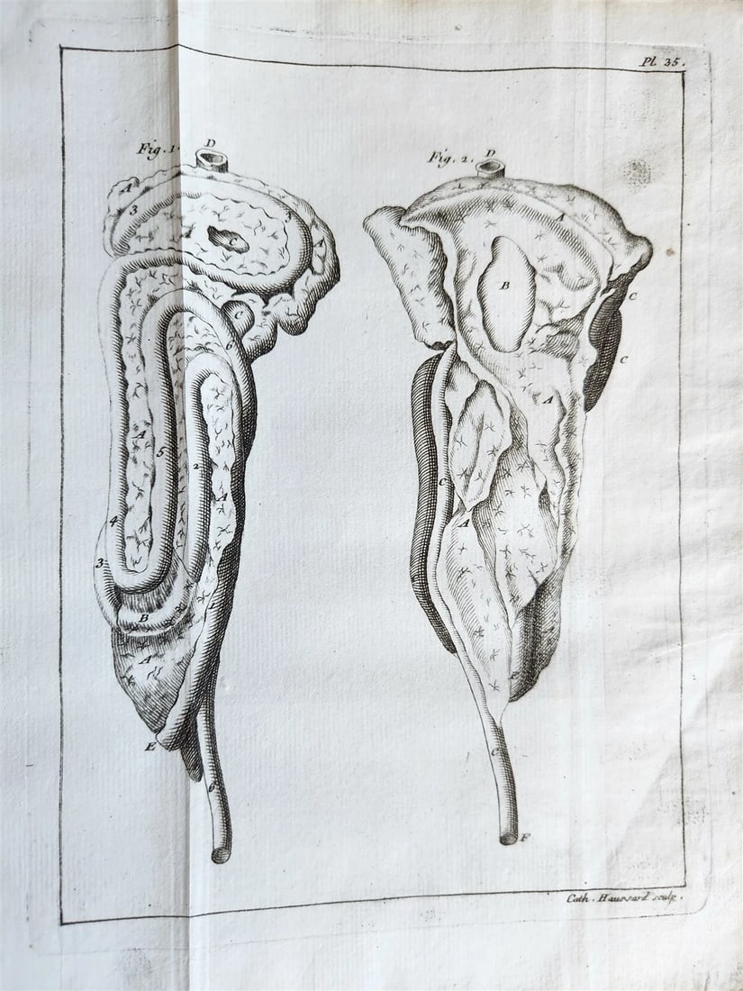 1749 MEDICAL TREATISE ILLUSTRATED ANATOMY by Francois PLANQUE antique V. 2 - 11
