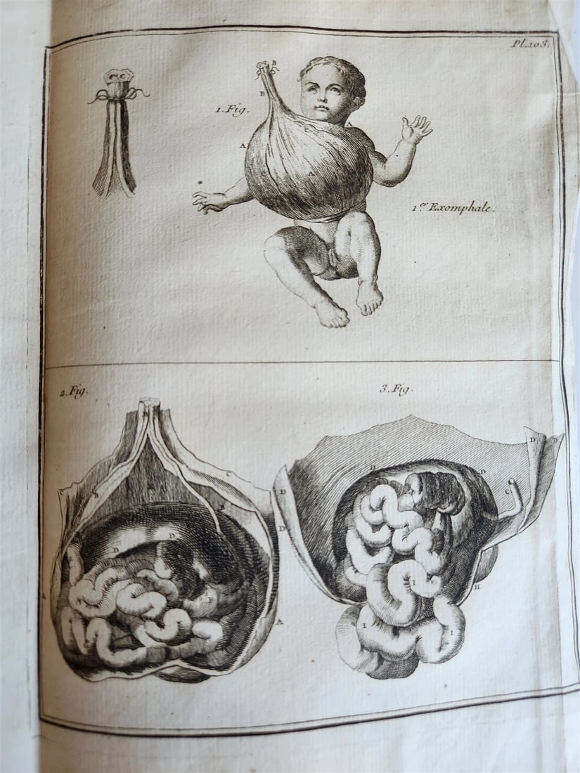 1759 MEDICAL TREATISE ILLUSTRATED ANATOMY by Francois PLANQUE antique V. 5 - 12