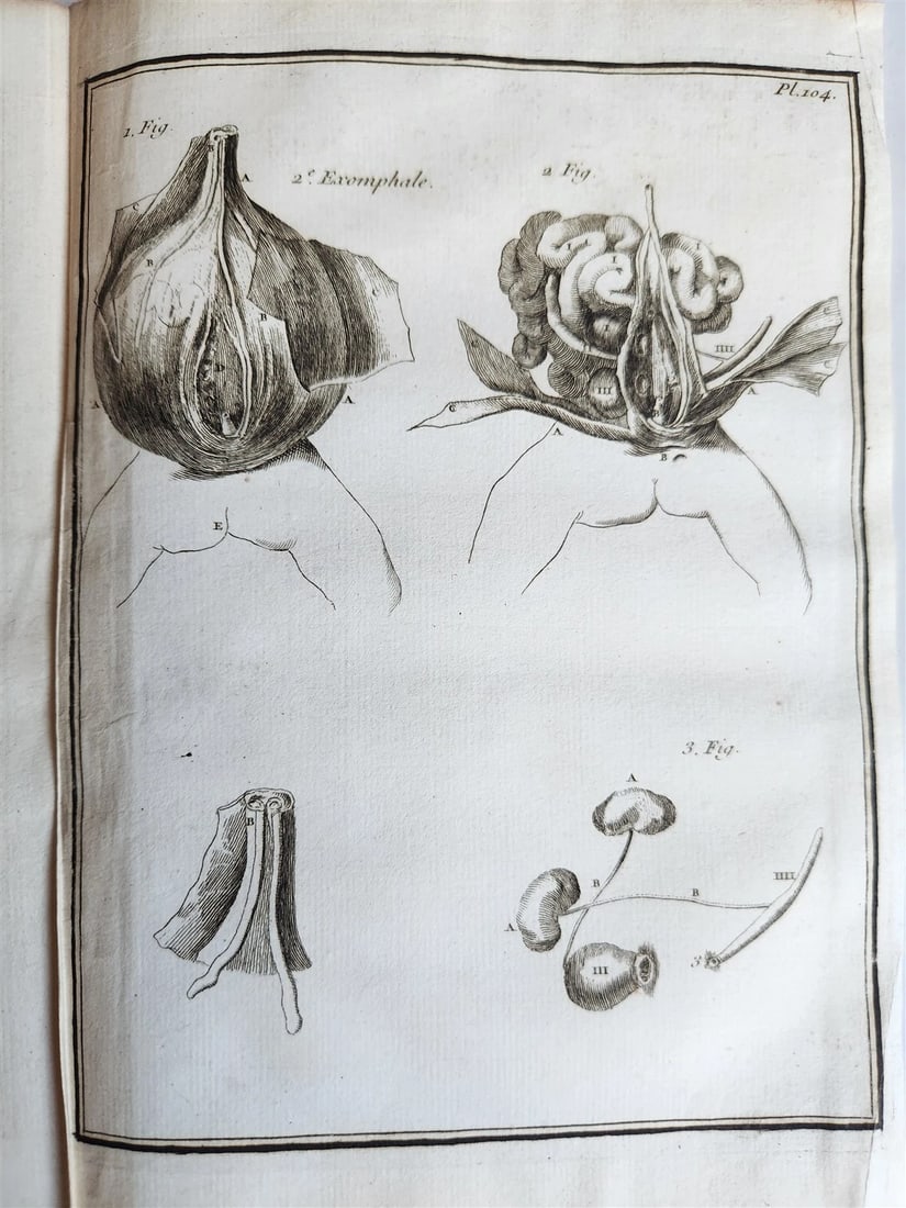 1759 MEDICAL TREATISE ILLUSTRATED ANATOMY by Francois PLANQUE antique V. 5 - 13