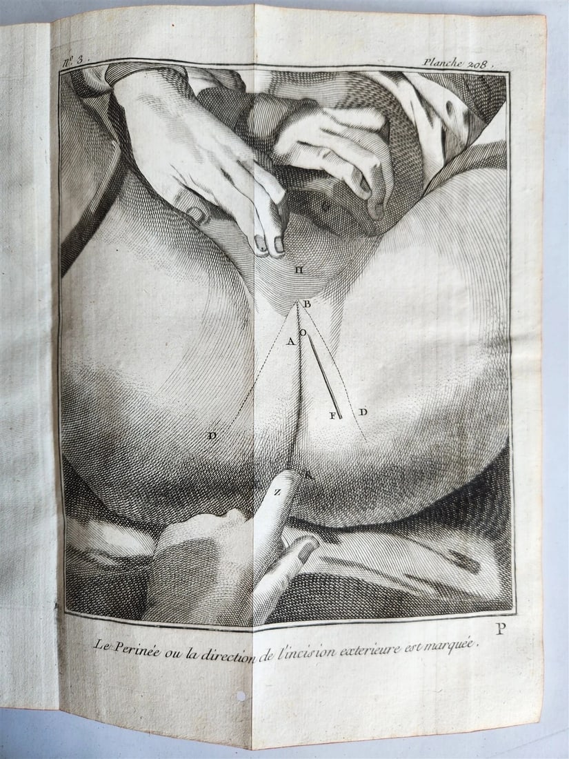 1770 MEDICAL TREATISE ILLUSTRATED ANATOMY by Francois PLANQUE antique V. 10 (1 of 20)