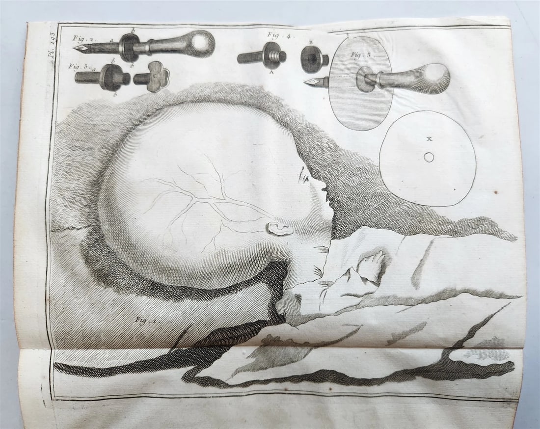 1766 MEDICAL TREATISE ILLUSTRATED ANATOMY by Francois PLANQUE antique V. 9 - 15