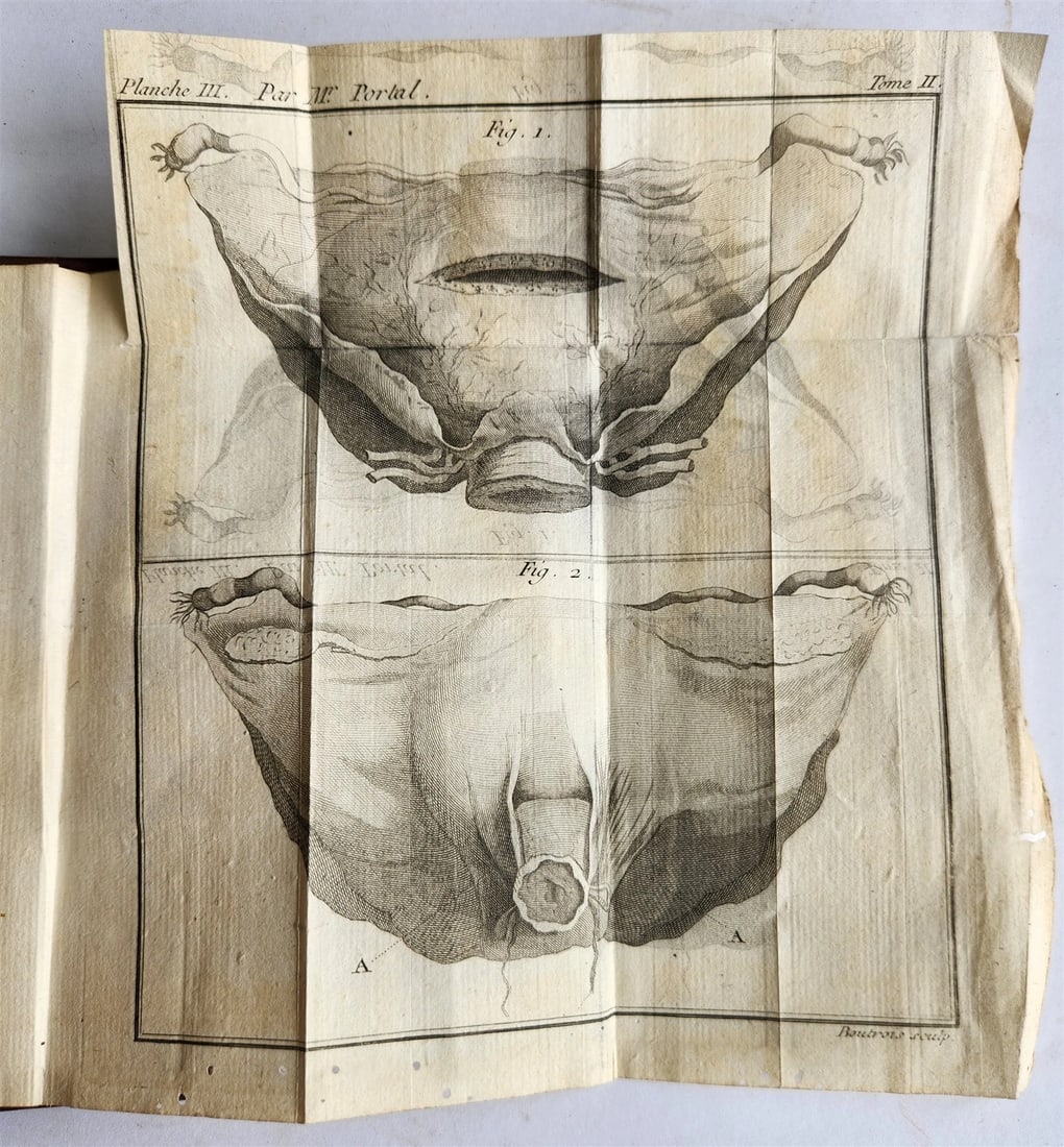 1777 ANATOMIE HISTORIQUE et PRATIQUE antique ILLUSTRATED (1 of 10)