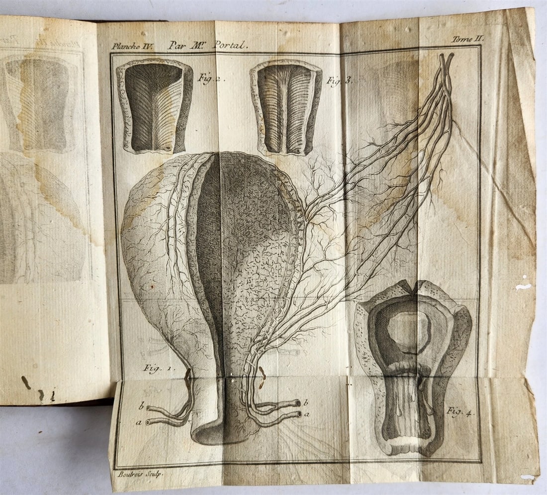 1777 ANATOMIE HISTORIQUE et PRATIQUE antique ILLUSTRATED - 5