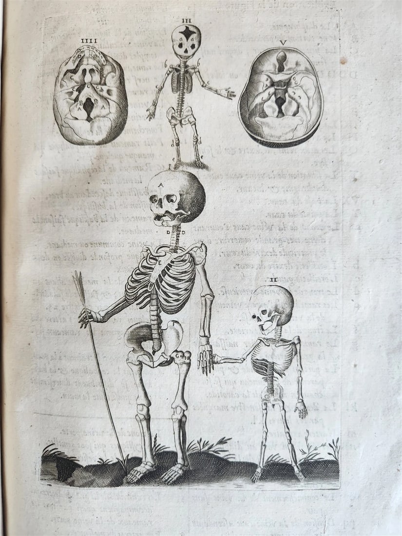 1646 ANATOMY ILLUSTRATED FOLIO antique MEDICAL Oeuvres de Me André dv Lavrens (1 of 20)