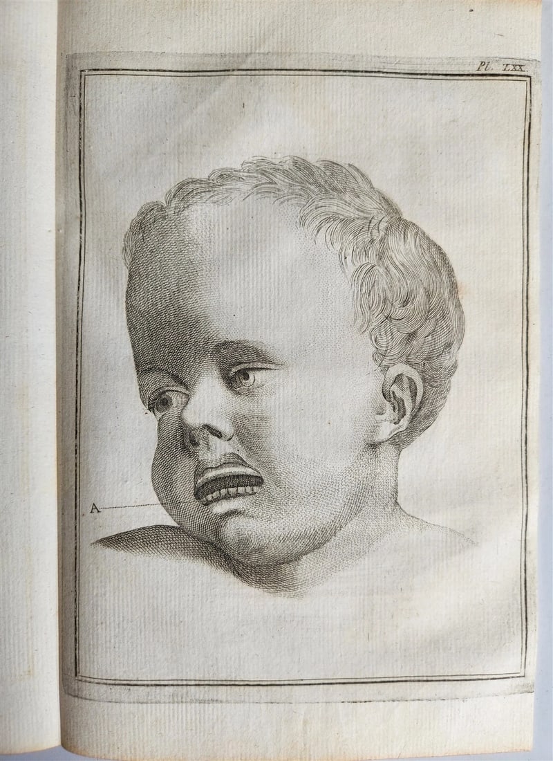 1763 MEDICAL TREATISE ILLUSTRATED ANATOMY by Francois PLANQUE antique V. 8 - 5