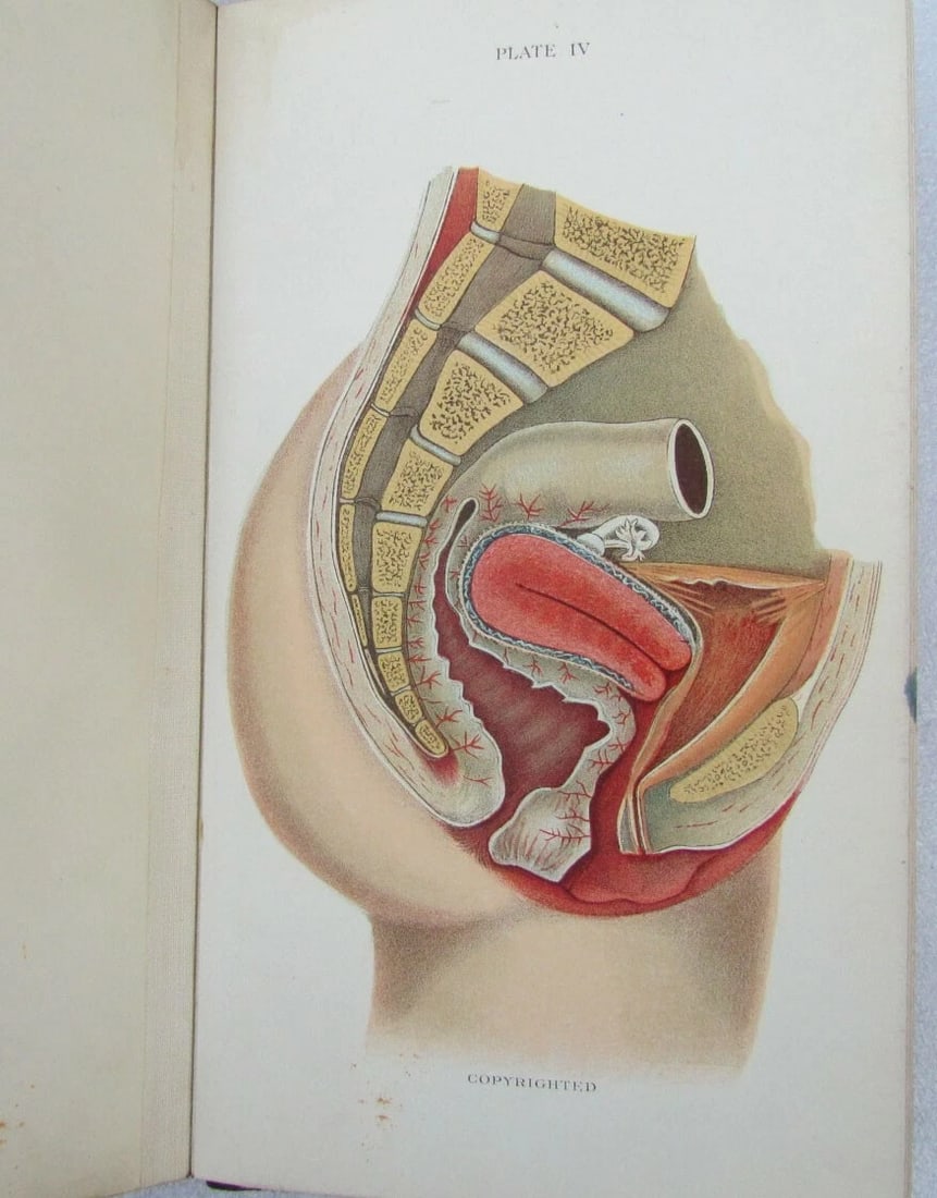 1909 GYNECOLOGICAL PLATES antique leather bound - 5