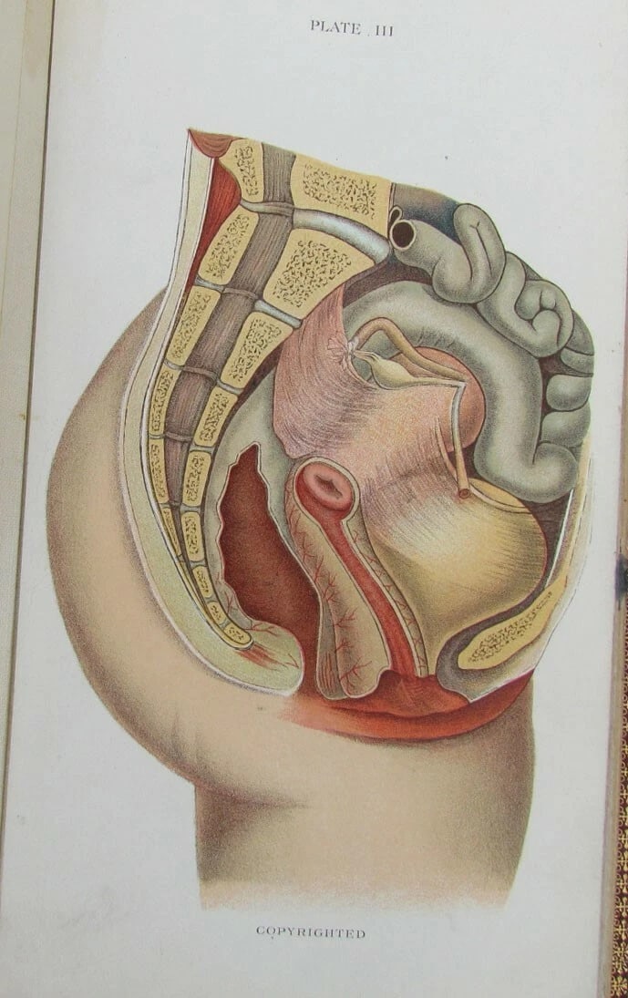 1909 GYNECOLOGICAL PLATES antique leather bound - 6