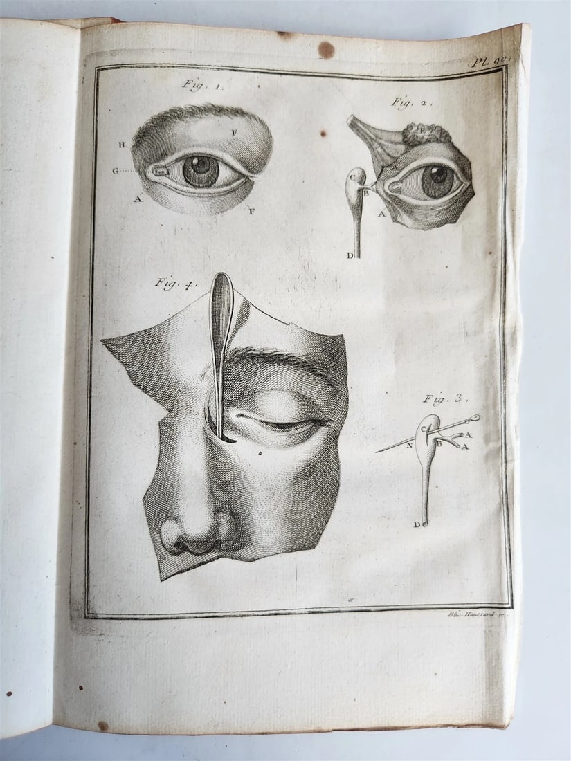 1753 MEDICAL TREATISE ILLUSTRATED ANATOMY by Francois PLANQUE antique V. 4 (1 of 20)