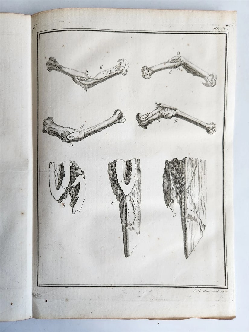 1753 MEDICAL TREATISE ILLUSTRATED ANATOMY by Francois PLANQUE antique V. 4 - 20