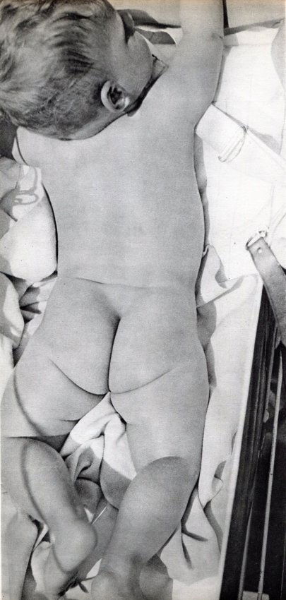 Herbert Bayer: Baby (1 of 1)