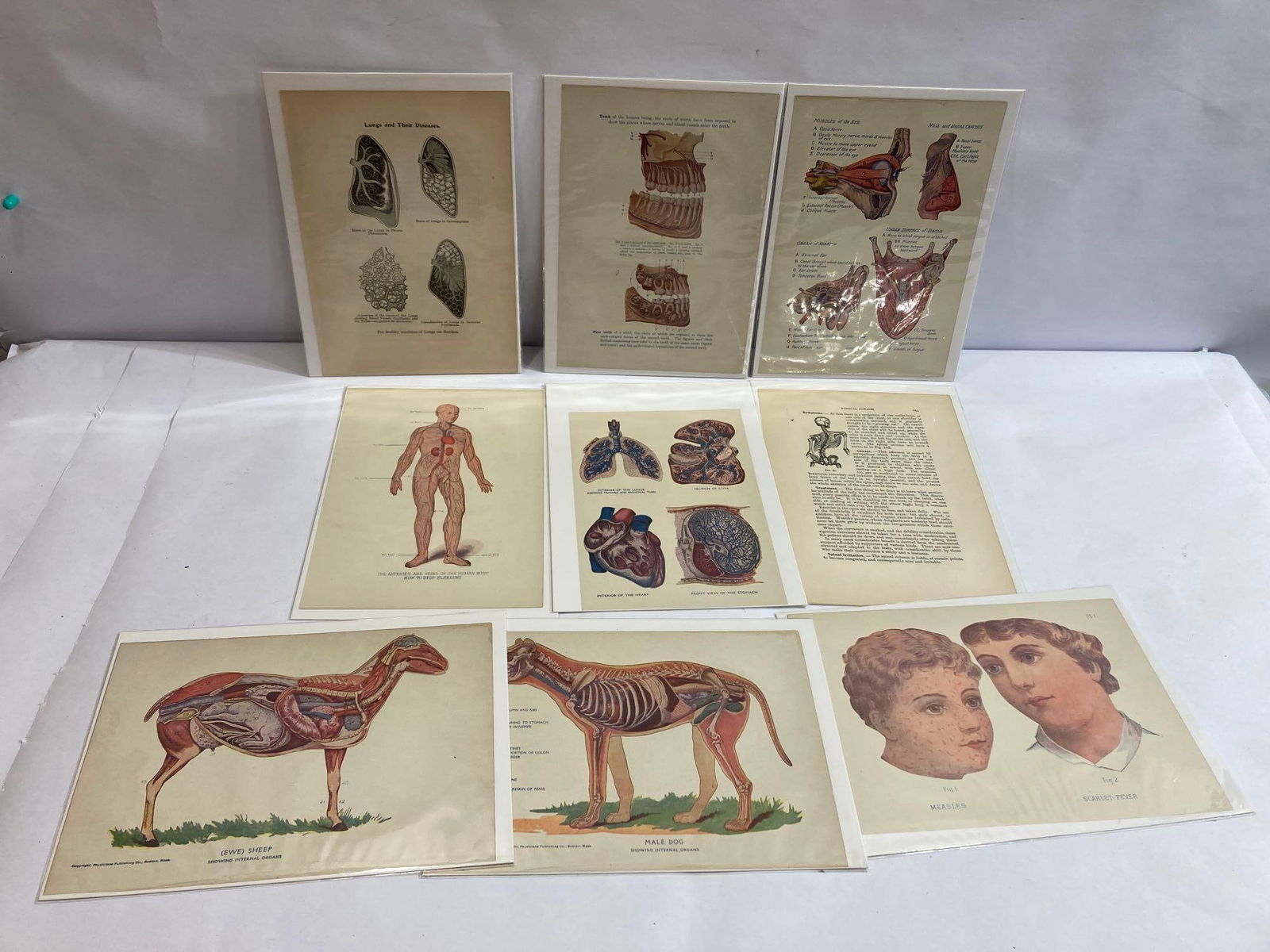 9 ANTIQUE MEDICAL LITHOGRAPHS (1 of 6)