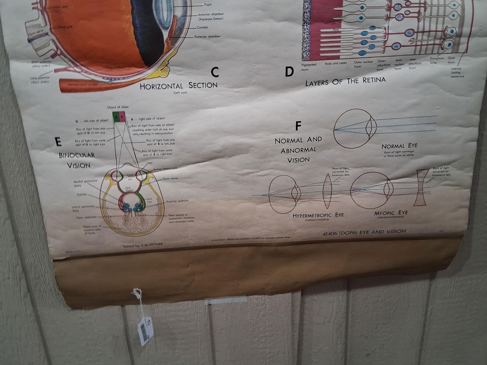 Early Eye & Vision Optometrist Pull Down Poster - 4