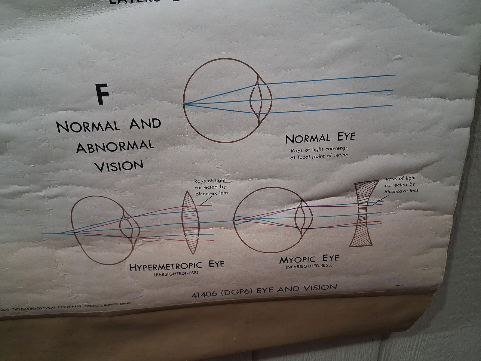 Early Eye & Vision Optometrist Pull Down Poster - 6