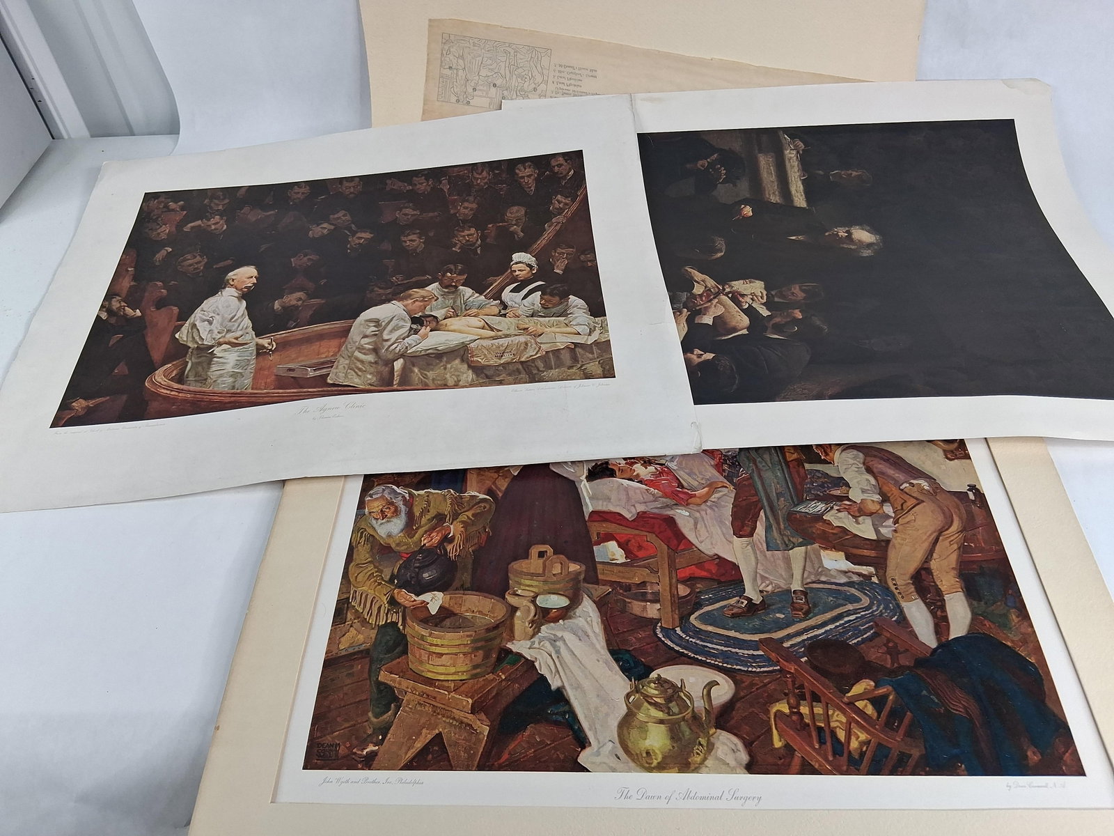 T. Eakins & D. Cornwell Medical History Prints (1 of 16)
