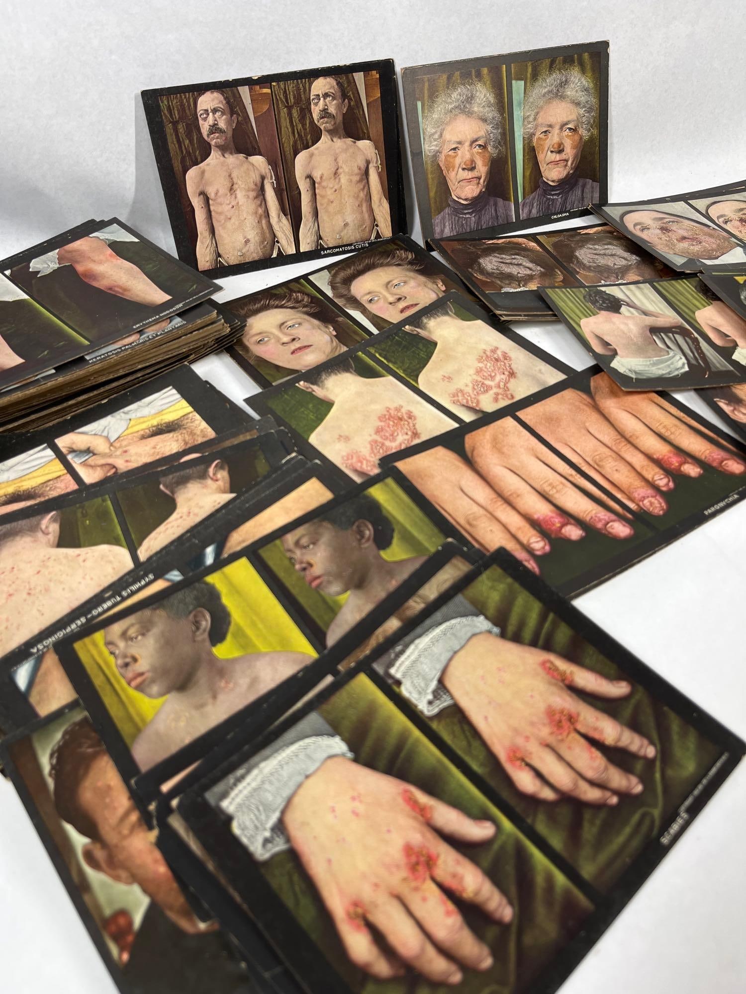 S. I. Rainforth Dermatology Stereoviews (1 of 5)