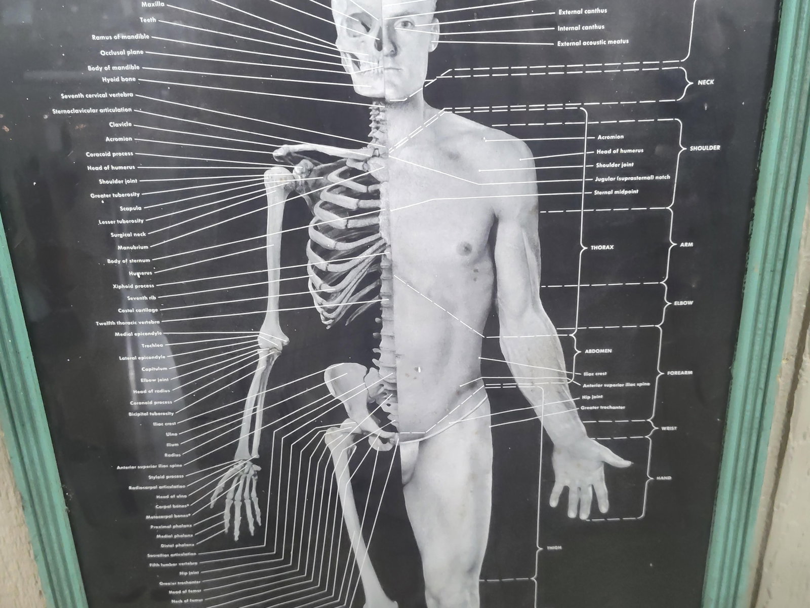 Framed Anatomical Human Wall Chart - 3