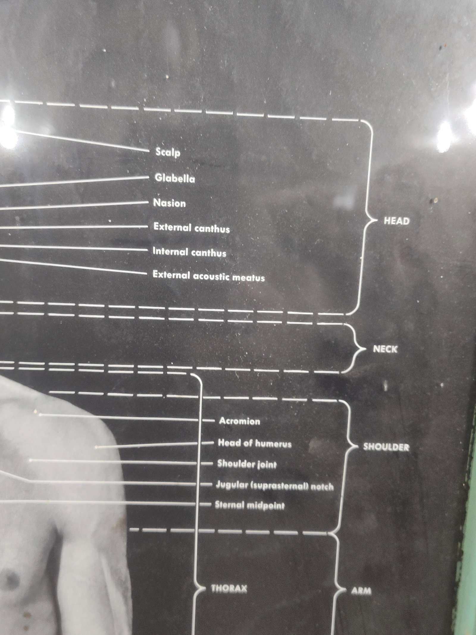 Framed Anatomical Human Wall Chart - 4