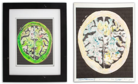 Bouzard-Hui Brain Scan Compositions Mixed Media, 2