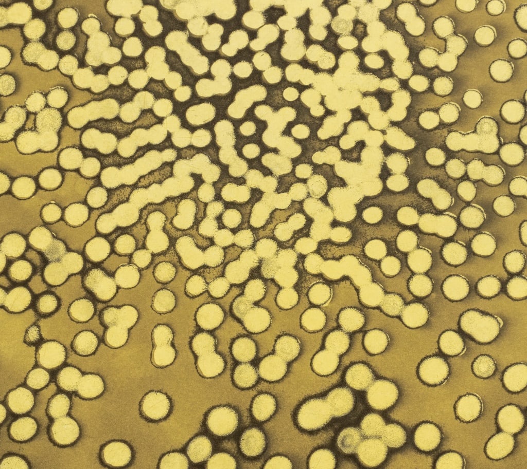 Ross Bleckner "Selection Sequence" Etching, 2002 - 4