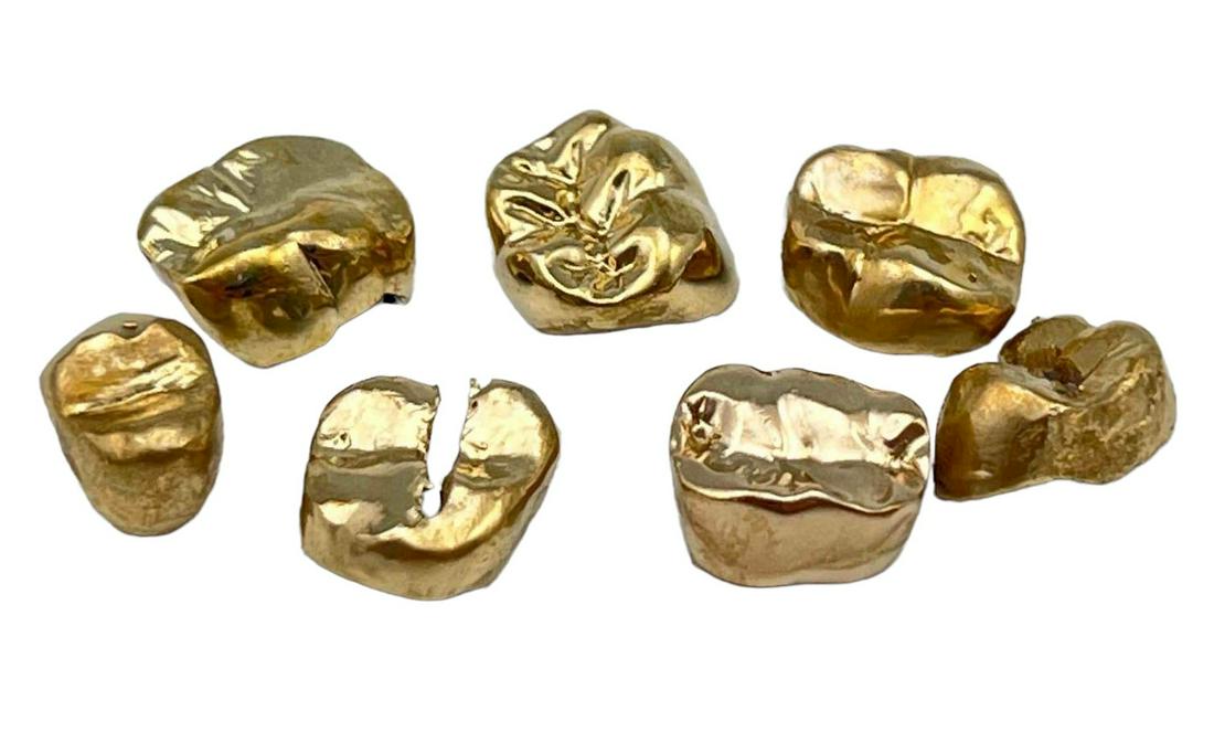 7 14K Gold Dental Crowns (1 of 5)