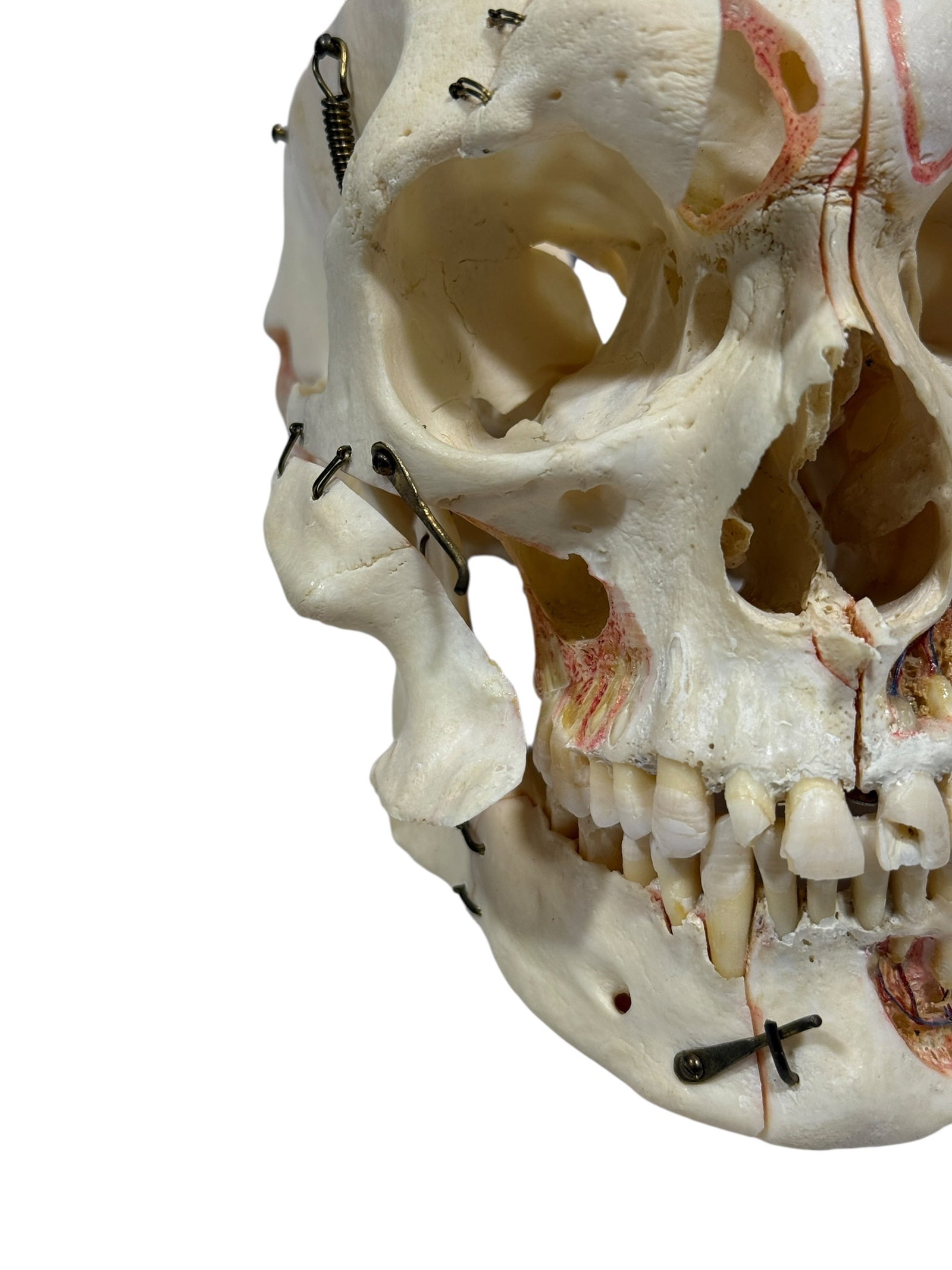 Kilgore International Human Anatomical Skull Specimen w/ Case - 10
