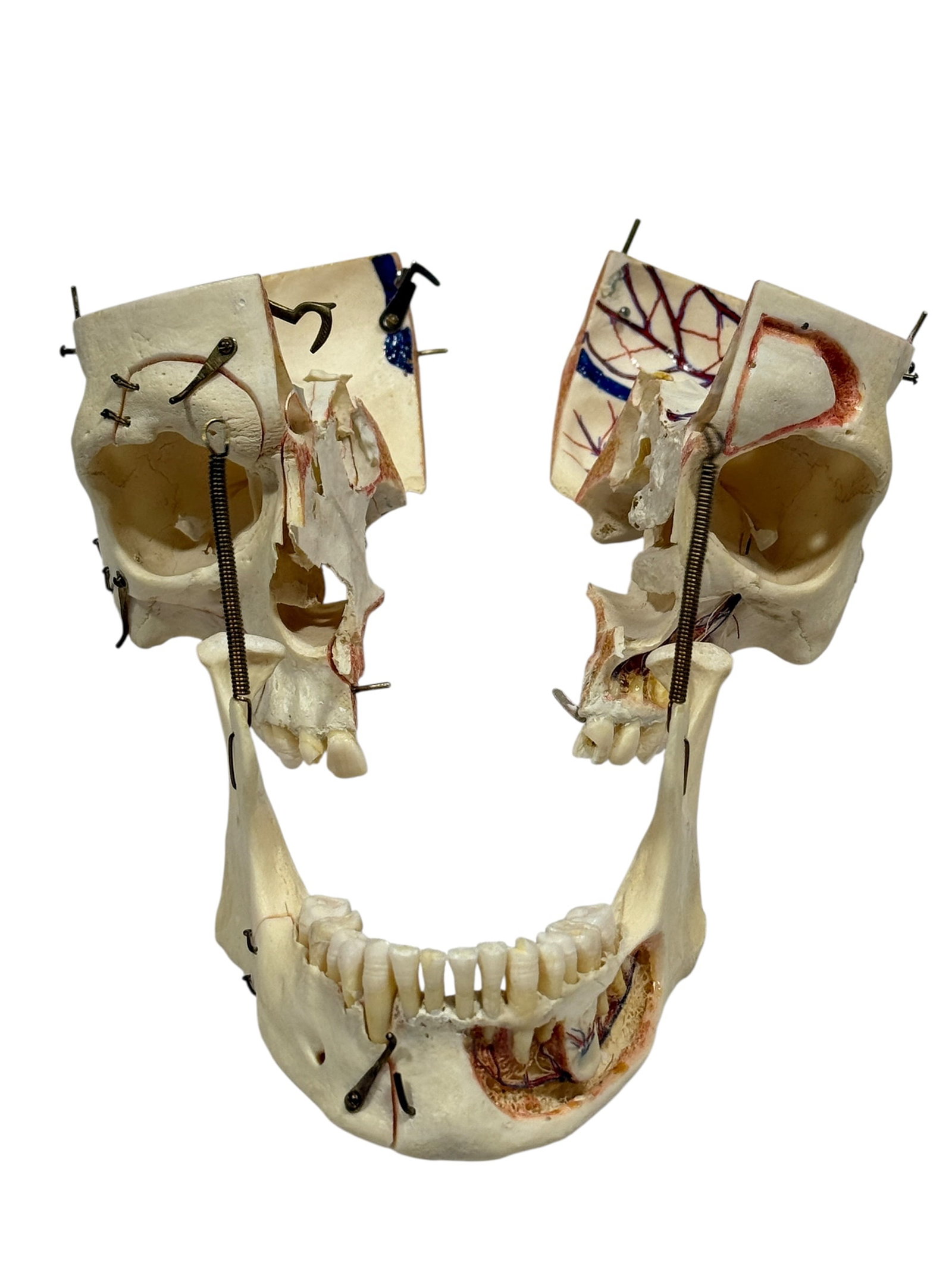 Kilgore International Human Anatomical Skull Specimen w/ Case - 12