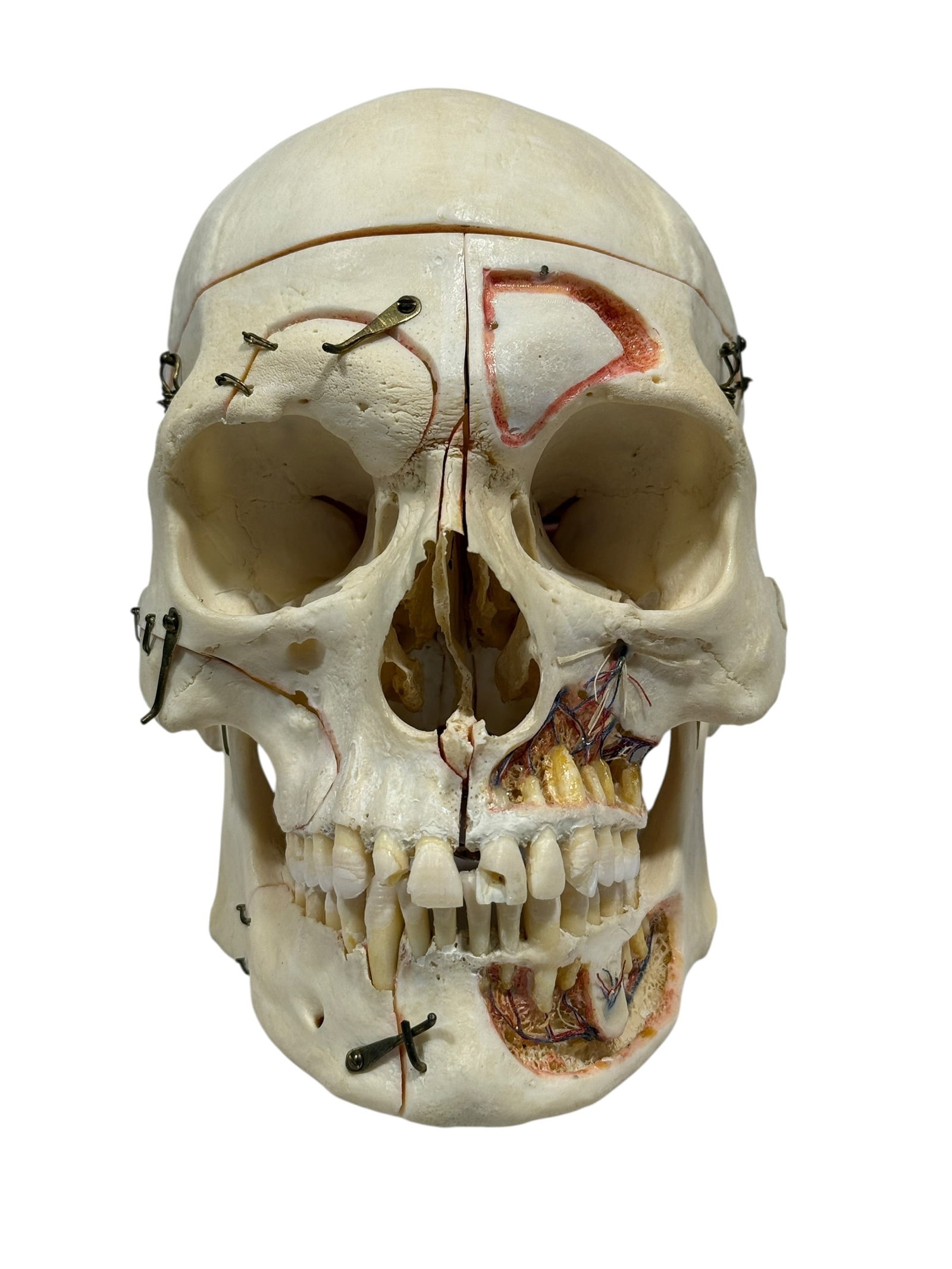 Kilgore International Human Anatomical Skull Specimen w/ Case - 2
