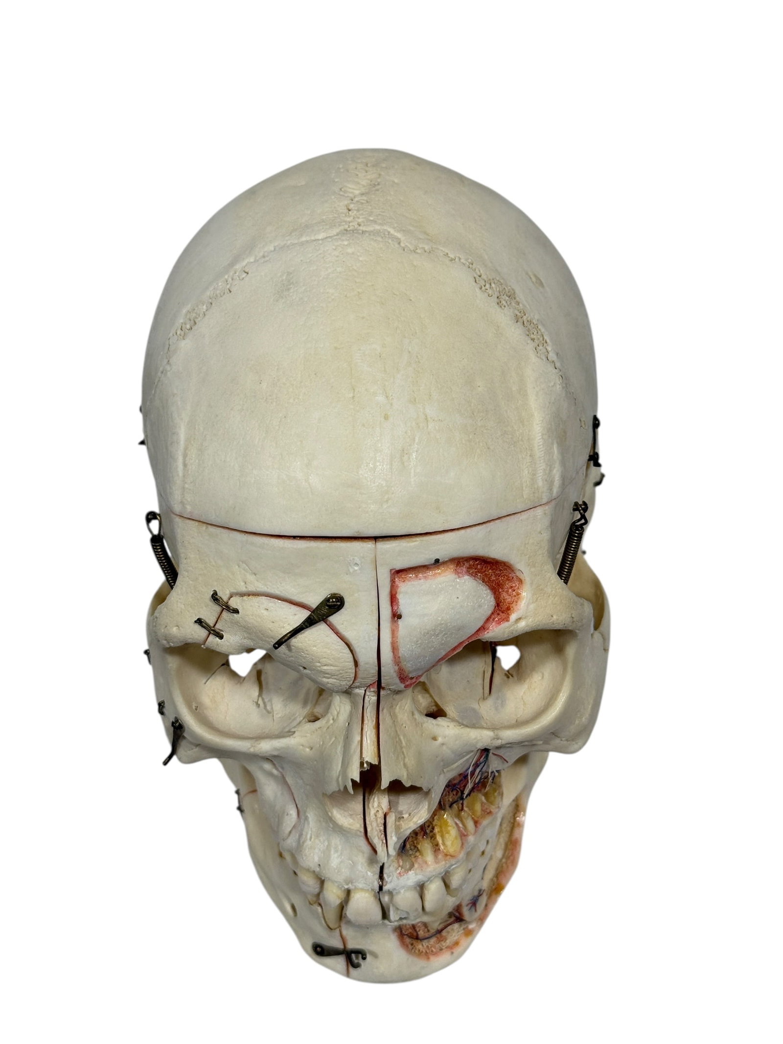 Kilgore International Human Anatomical Skull Specimen w/ Case - 3