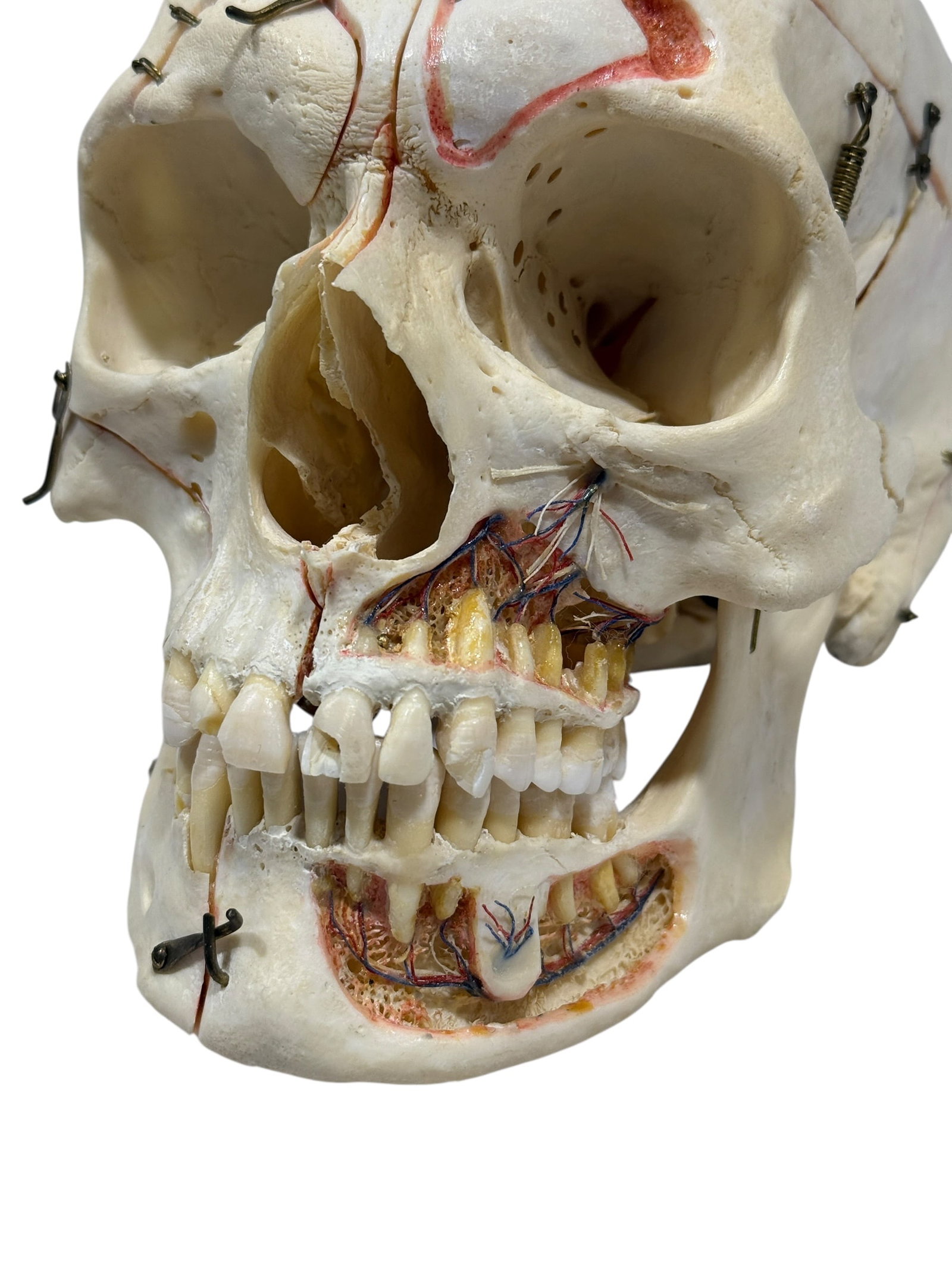 Kilgore International Human Anatomical Skull Specimen w/ Case - 4
