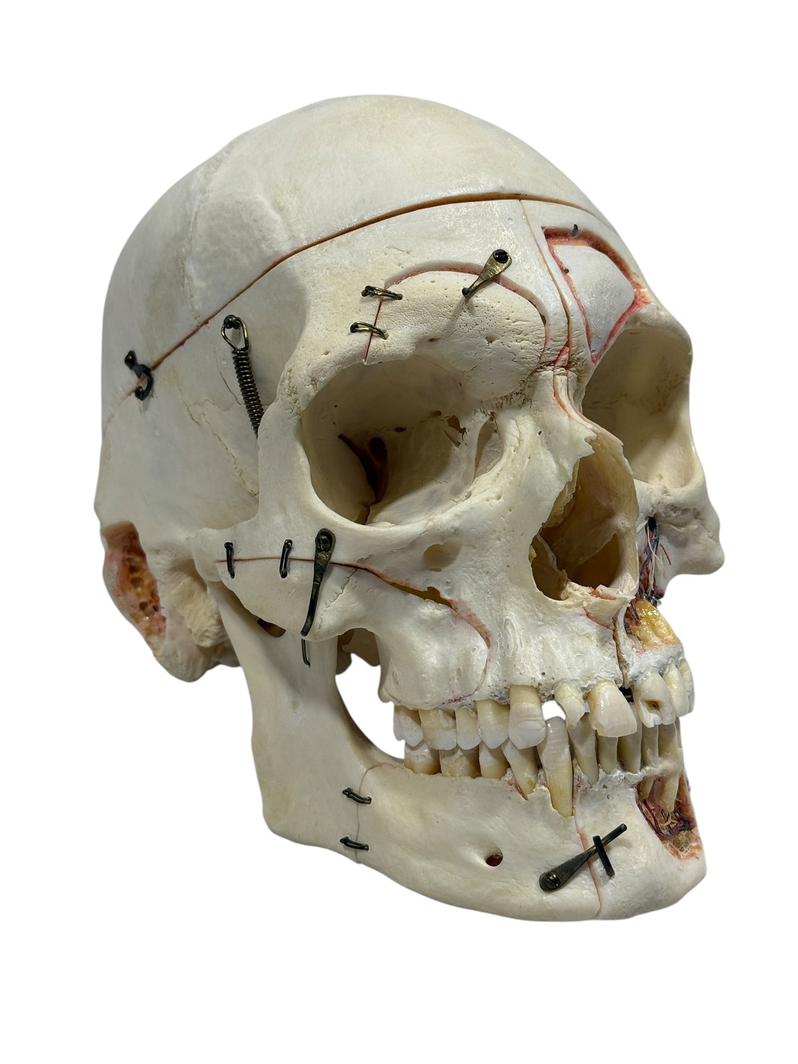 Kilgore International Human Anatomical Skull Specimen w/ Case - 5