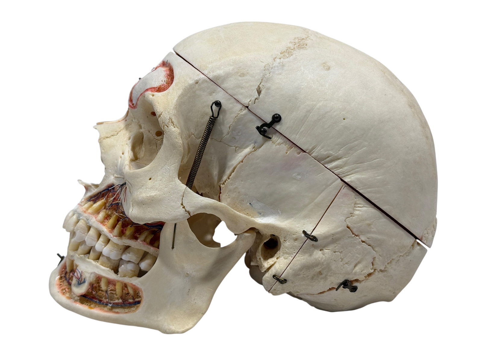 Kilgore International Human Anatomical Skull Specimen w/ Case - 6