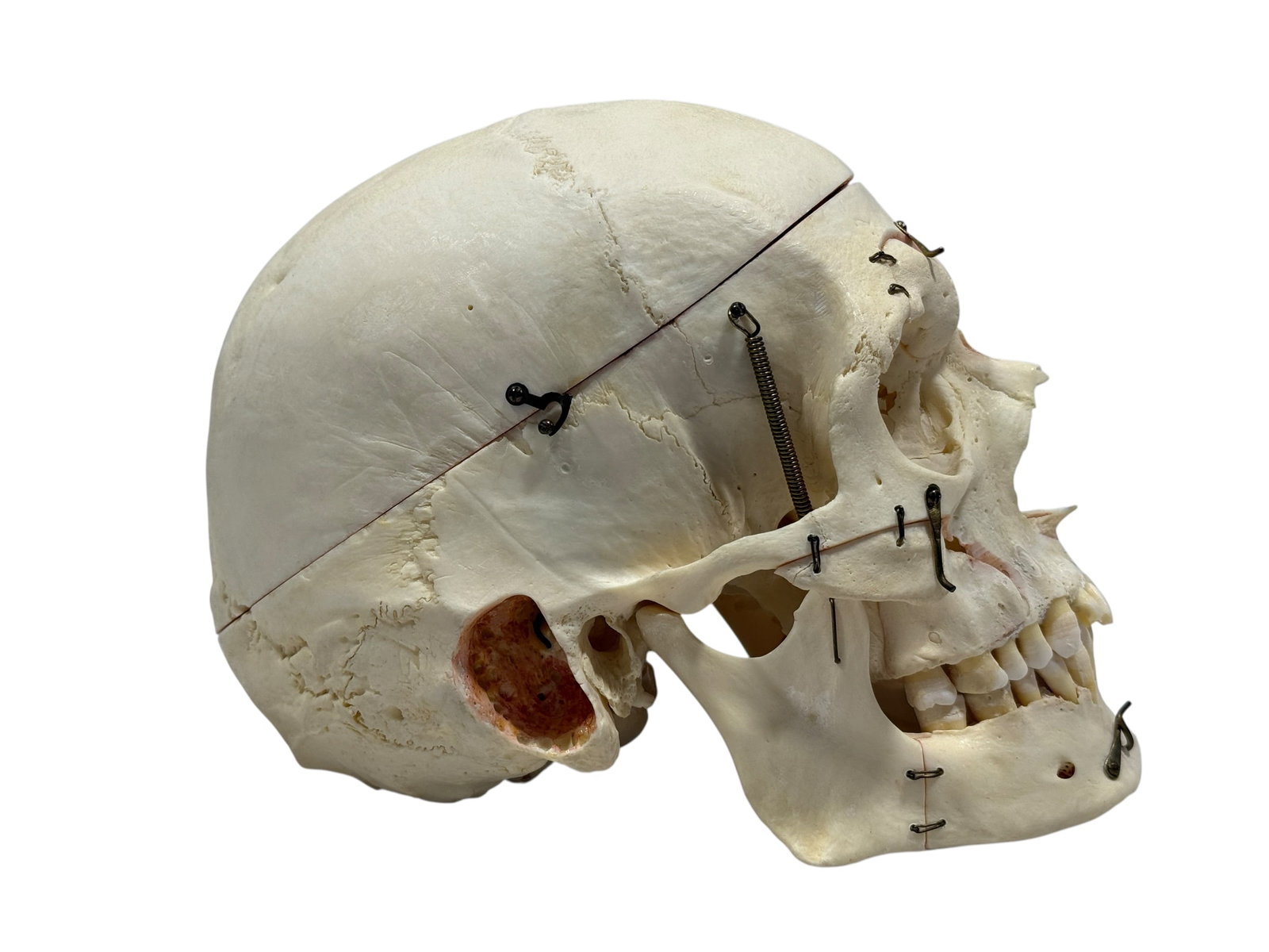 Kilgore International Human Anatomical Skull Specimen w/ Case - 7