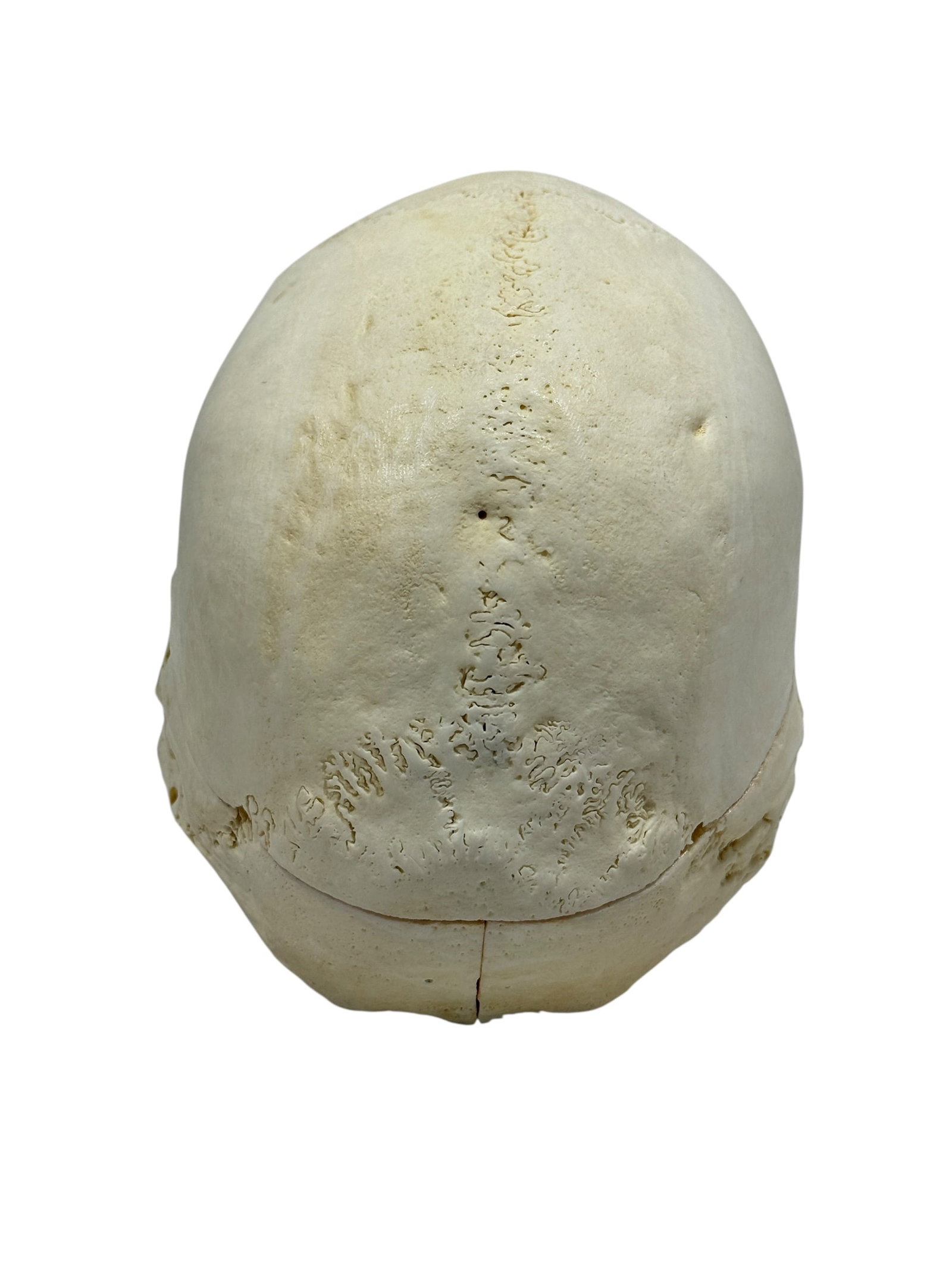 Kilgore International Human Anatomical Skull Specimen w/ Case - 8