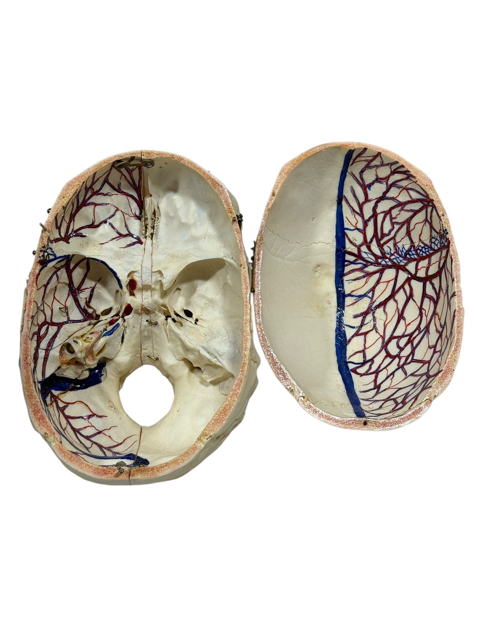 Kilgore International Human Anatomical Skull Specimen w/ Case - 9