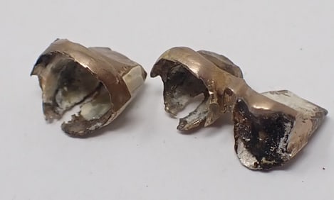Gold Teeth