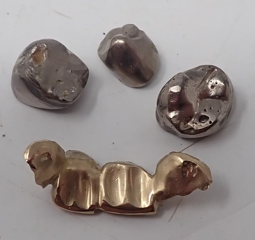 Dental Fillings (1 of 2)