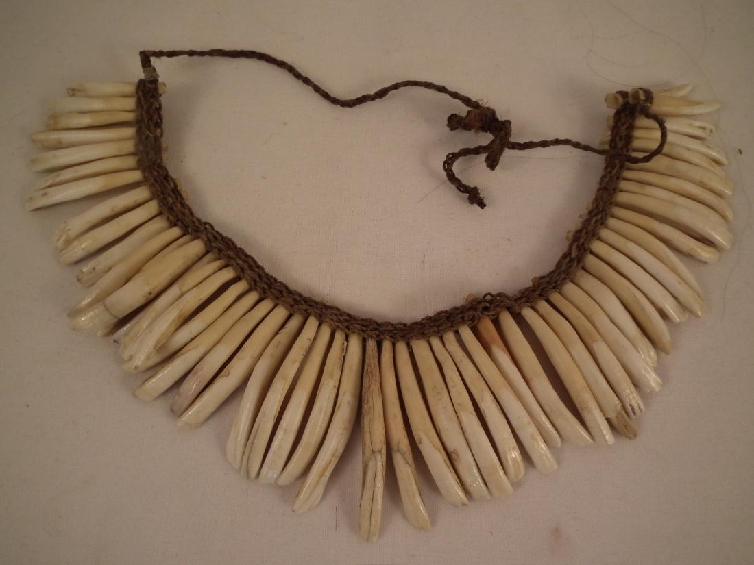 dog tooth necklace