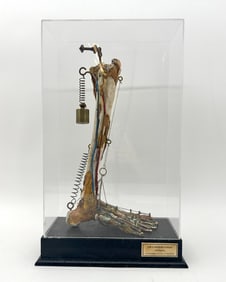 Cased Foot Medical Anatomy Specimen