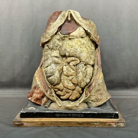 French Anatomical Model, Augier Nicolas Roux