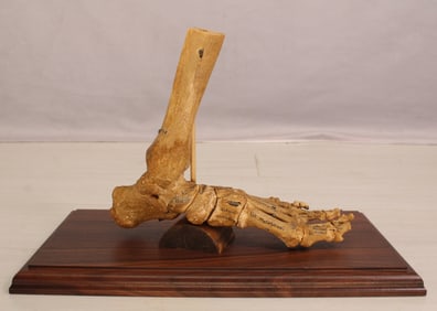 Medical Specimen, Human Foot On Stand