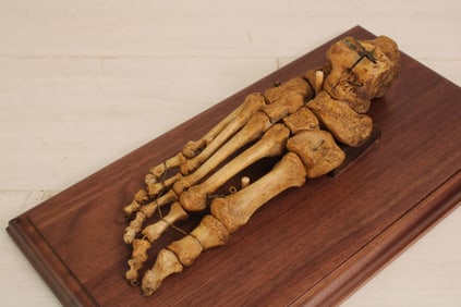 Skeletal Human Foot On Stand, Anatomical Aide